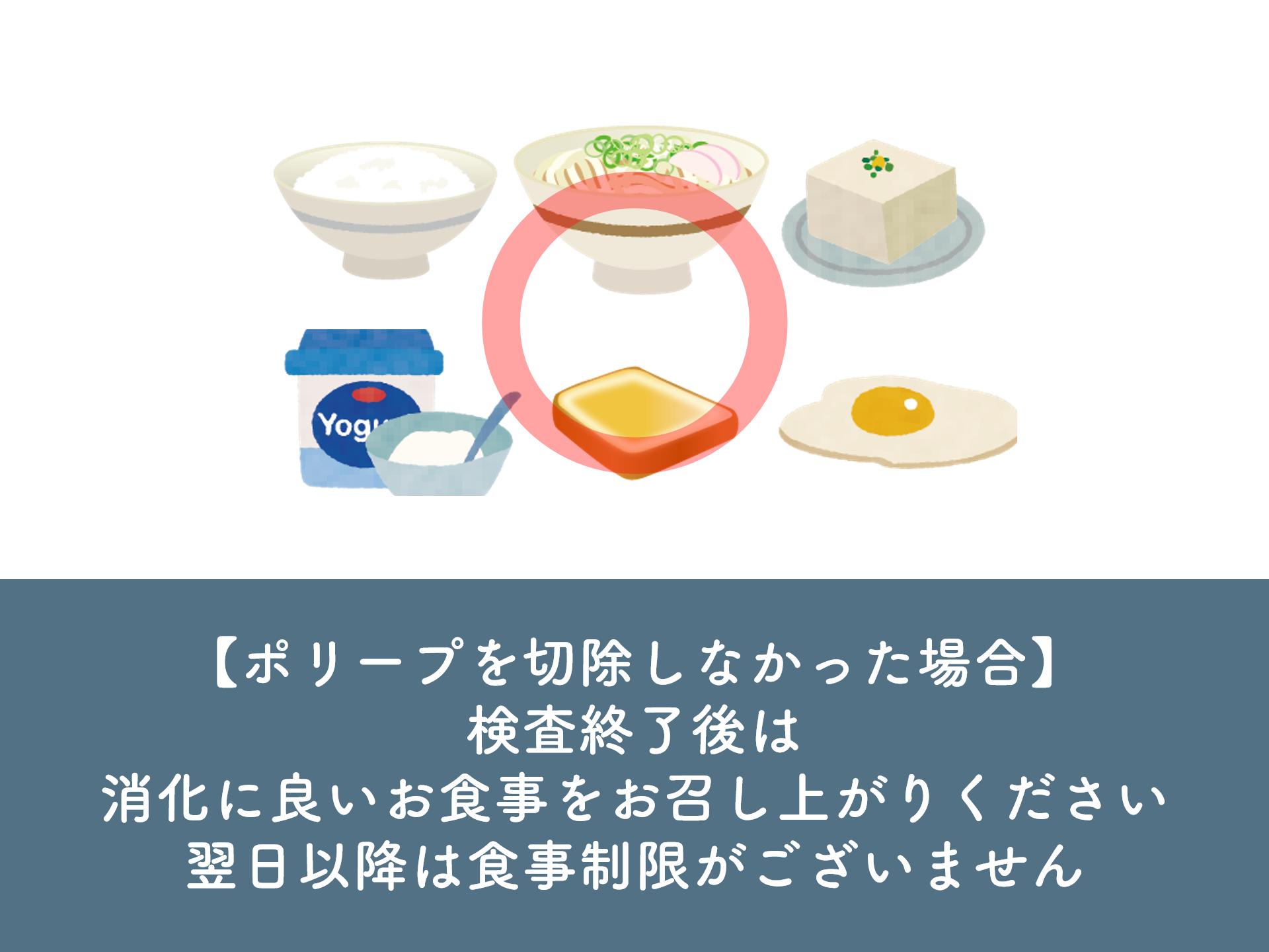 大腸カメラ検査説明